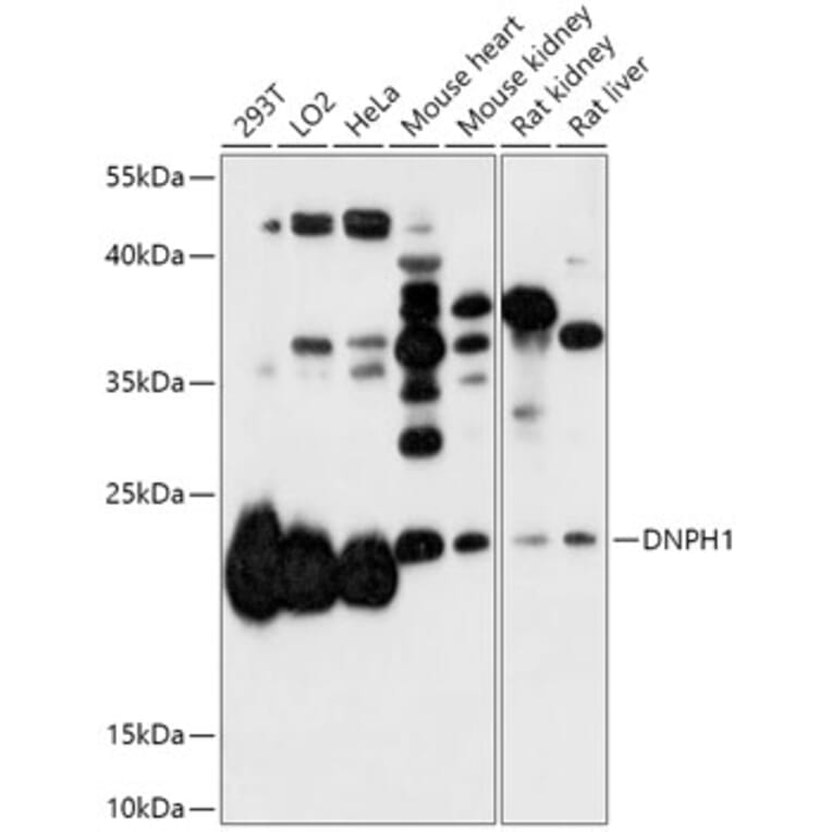 Western Blot - Anti-RCL Antibody (A306783) - Antibodies.com
