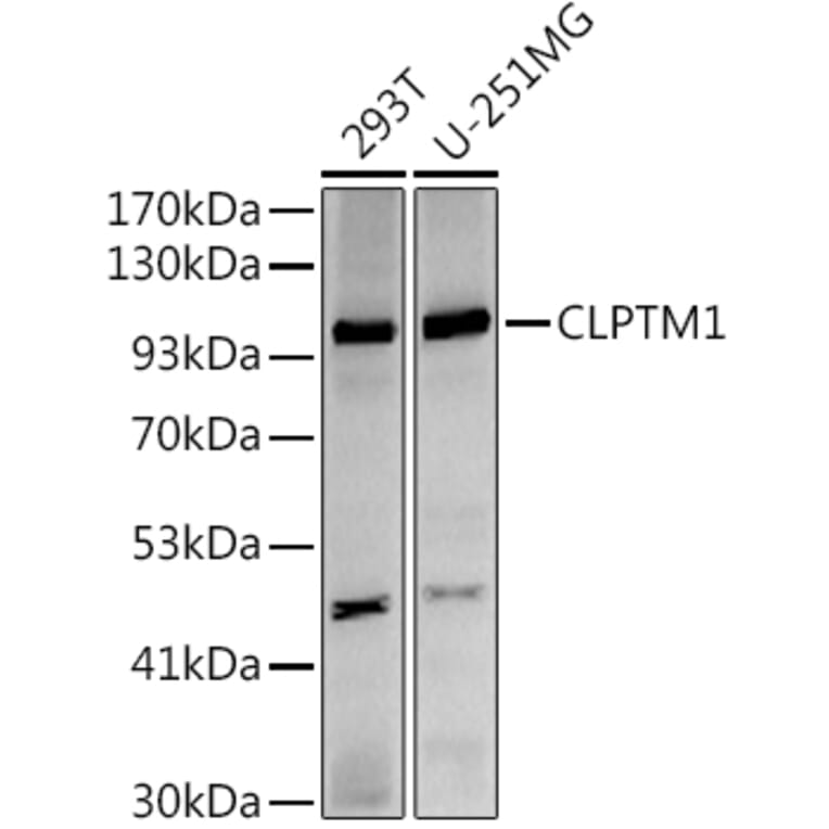 Western Blot - Anti-CLPTM1 Antibody [ARC2720] (A306784) - Antibodies.com