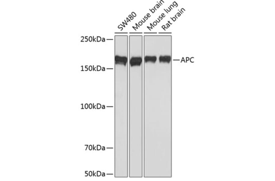 Western Blot - Anti-APC Antibody [ARC0346] (A306785) - Antibodies.com