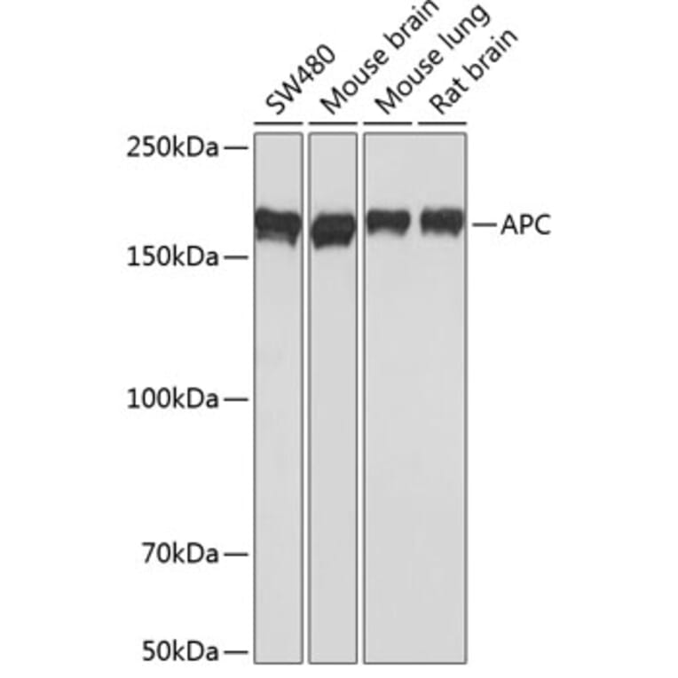 Western Blot - Anti-APC Antibody [ARC0346] (A306785) - Antibodies.com