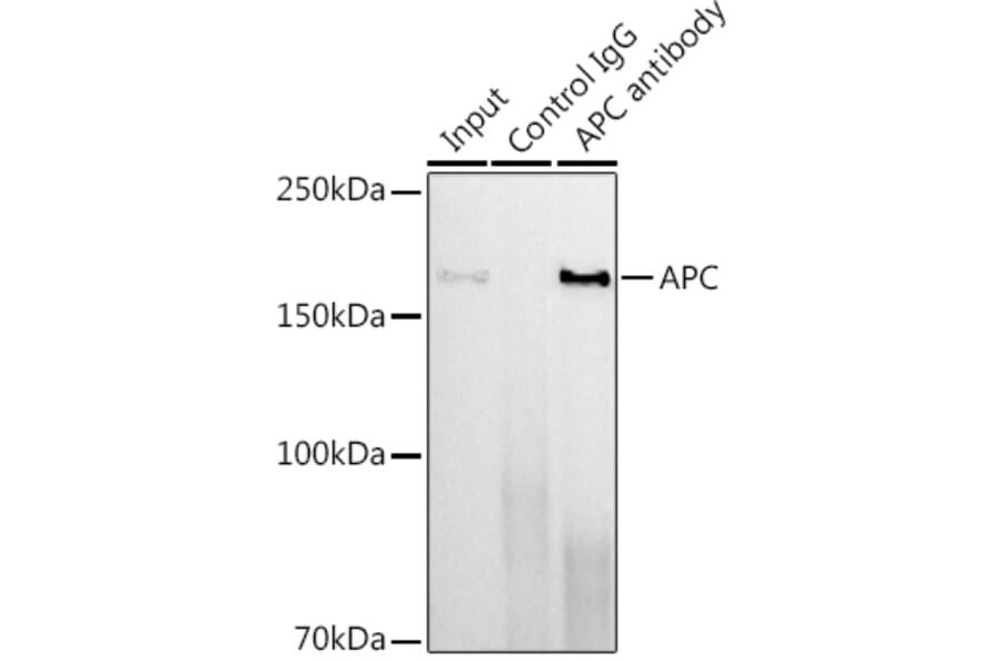 Western Blot - Anti-APC Antibody [ARC0346] (A306785) - Antibodies.com
