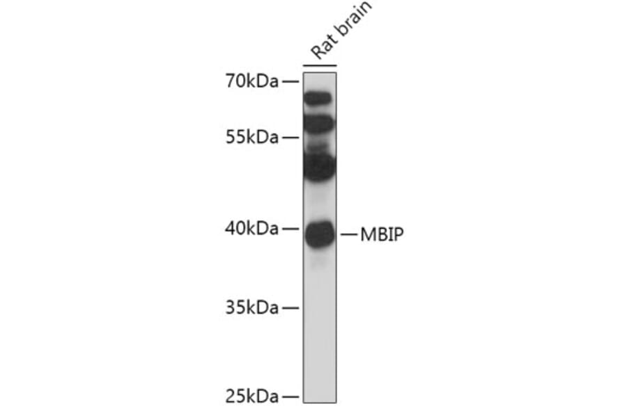 Western Blot - Anti-MBIP Antibody (A306786) - Antibodies.com