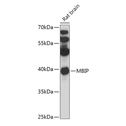 Western Blot - Anti-MBIP Antibody (A306786) - Antibodies.com