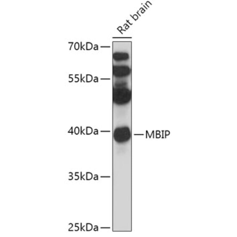 Western Blot - Anti-MBIP Antibody (A306786) - Antibodies.com