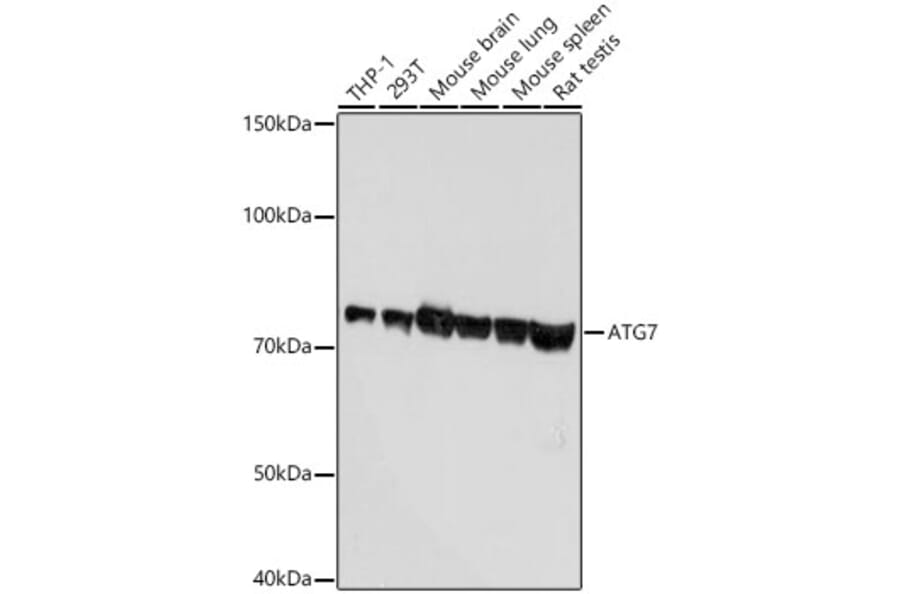 Western Blot - Anti-ATG7 Antibody [ARC0083] (A306787) - Antibodies.com