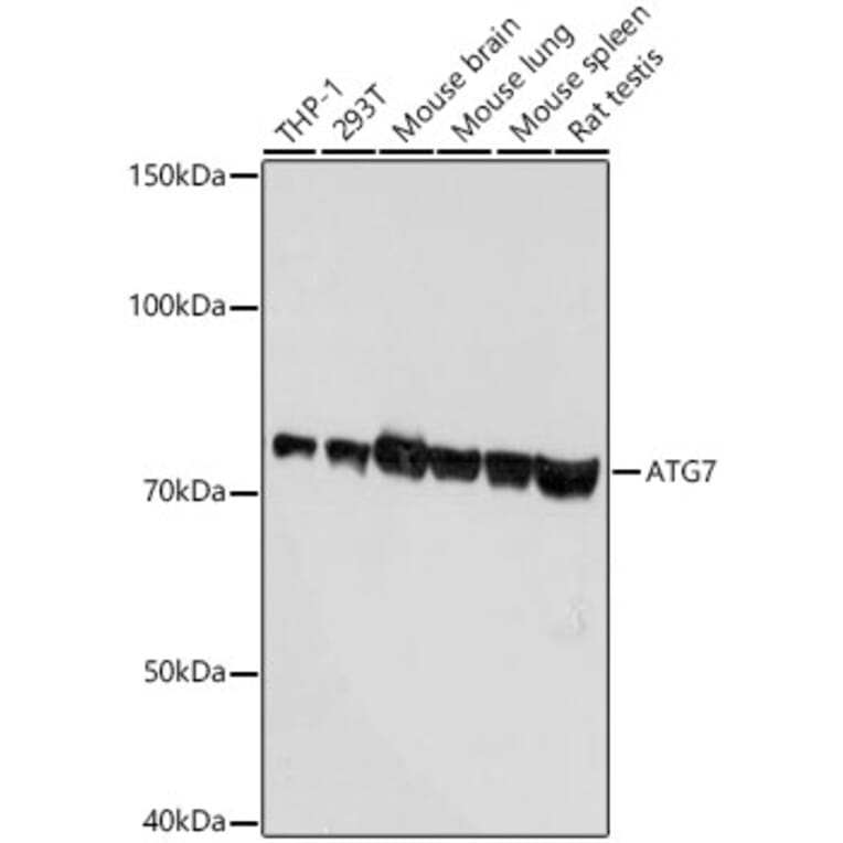 Western Blot - Anti-ATG7 Antibody [ARC0083] (A306787) - Antibodies.com