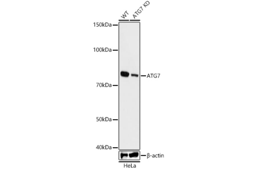 Western Blot - Anti-ATG7 Antibody [ARC0083] (A306787) - Antibodies.com