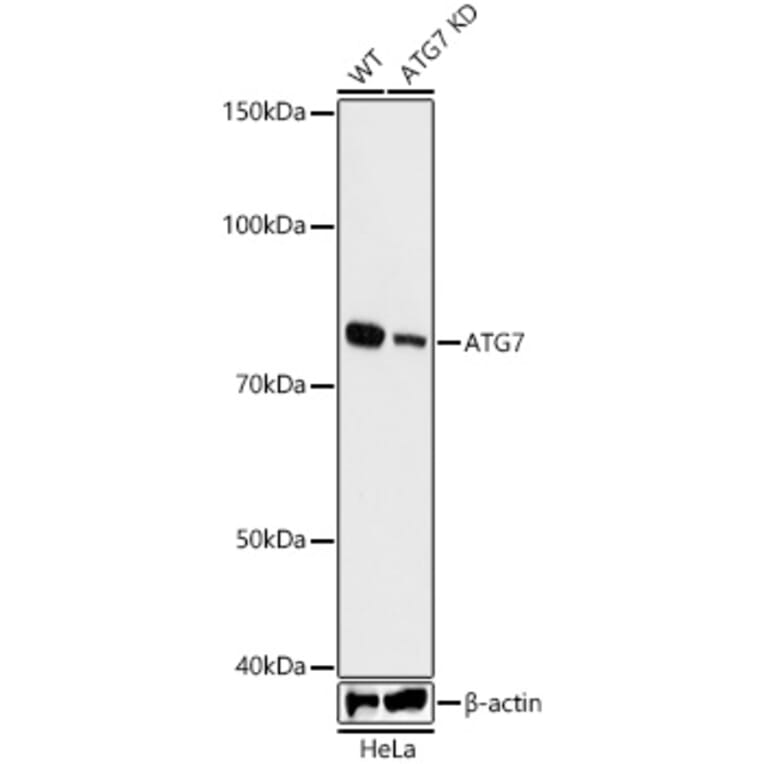 Western Blot - Anti-ATG7 Antibody [ARC0083] (A306787) - Antibodies.com