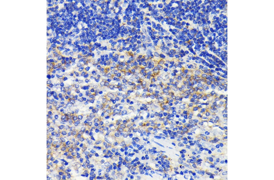 Immunohistochemistry - Anti-ATG7 Antibody [ARC0083] (A306787) - Antibodies.com