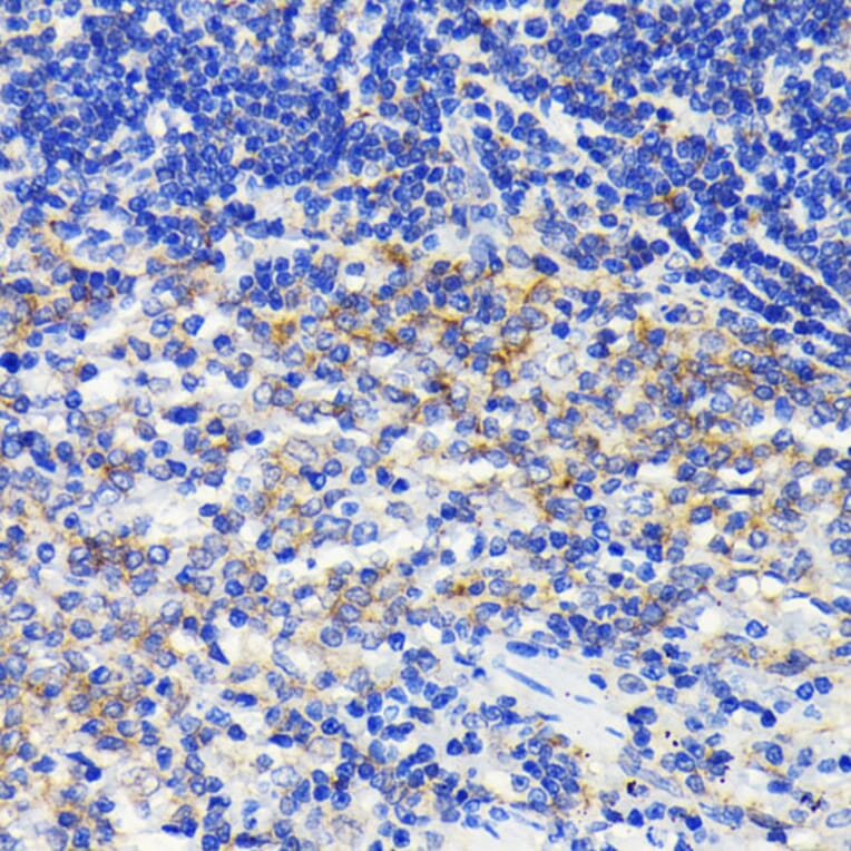 Immunohistochemistry - Anti-ATG7 Antibody [ARC0083] (A306787) - Antibodies.com