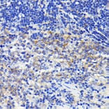 Immunohistochemistry - Anti-ATG7 Antibody [ARC0083] (A306787) - Antibodies.com