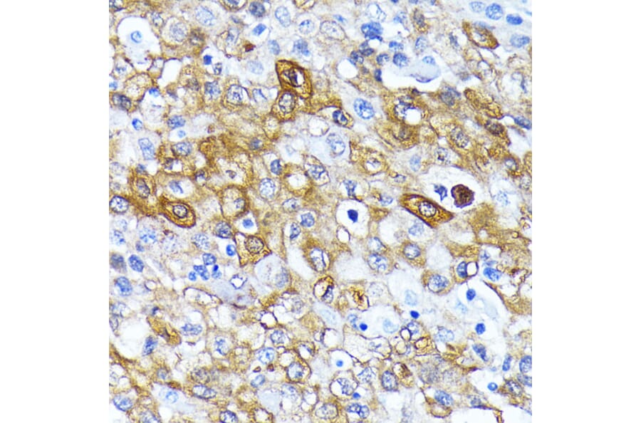 Immunohistochemistry - Anti-ATG7 Antibody [ARC0083] (A306787) - Antibodies.com
