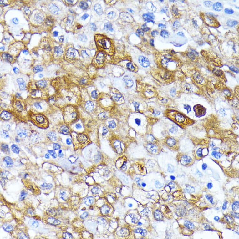 Immunohistochemistry - Anti-ATG7 Antibody [ARC0083] (A306787) - Antibodies.com
