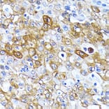 Immunohistochemistry - Anti-ATG7 Antibody [ARC0083] (A306787) - Antibodies.com