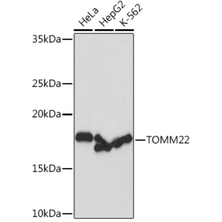Western Blot - Anti-TOMM22/TOM22 Antibody [ARC1688] (A306788) - Antibodies.com