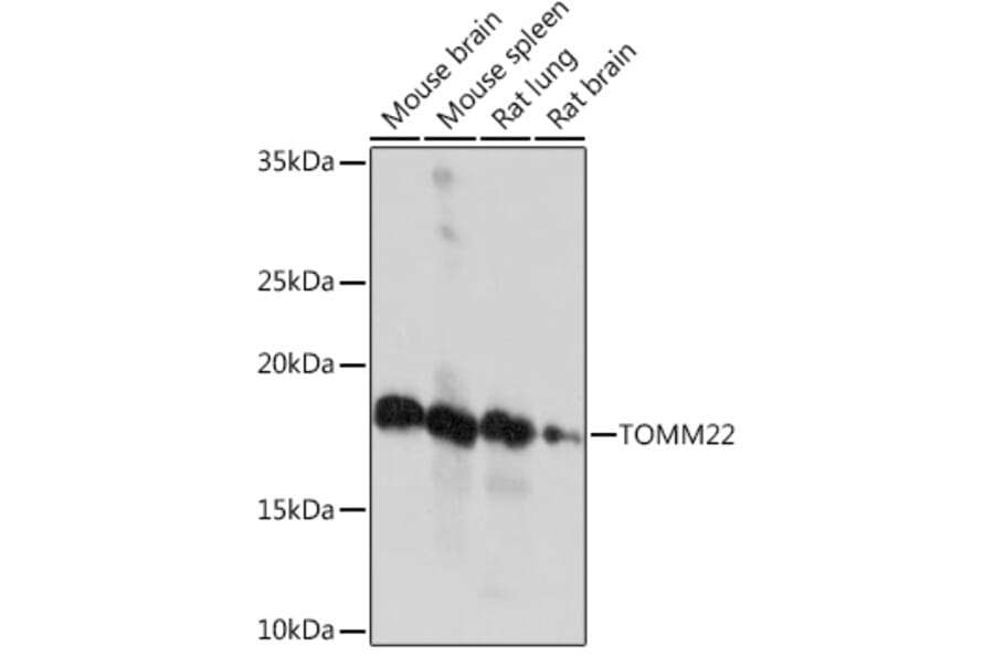 Western Blot - Anti-TOMM22/TOM22 Antibody [ARC1688] (A306788) - Antibodies.com