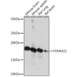Western Blot - Anti-TOMM22/TOM22 Antibody [ARC1688] (A306788) - Antibodies.com