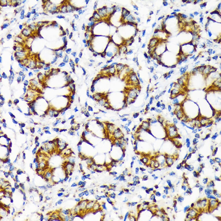 Immunohistochemistry - Anti-TOMM22/TOM22 Antibody [ARC1688] (A306788) - Antibodies.com