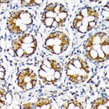 Immunohistochemistry - Anti-TOMM22/TOM22 Antibody [ARC1688] (A306788) - Antibodies.com