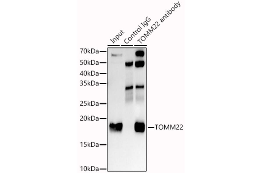 Western Blot - Anti-TOMM22/TOM22 Antibody [ARC1688] (A306788) - Antibodies.com