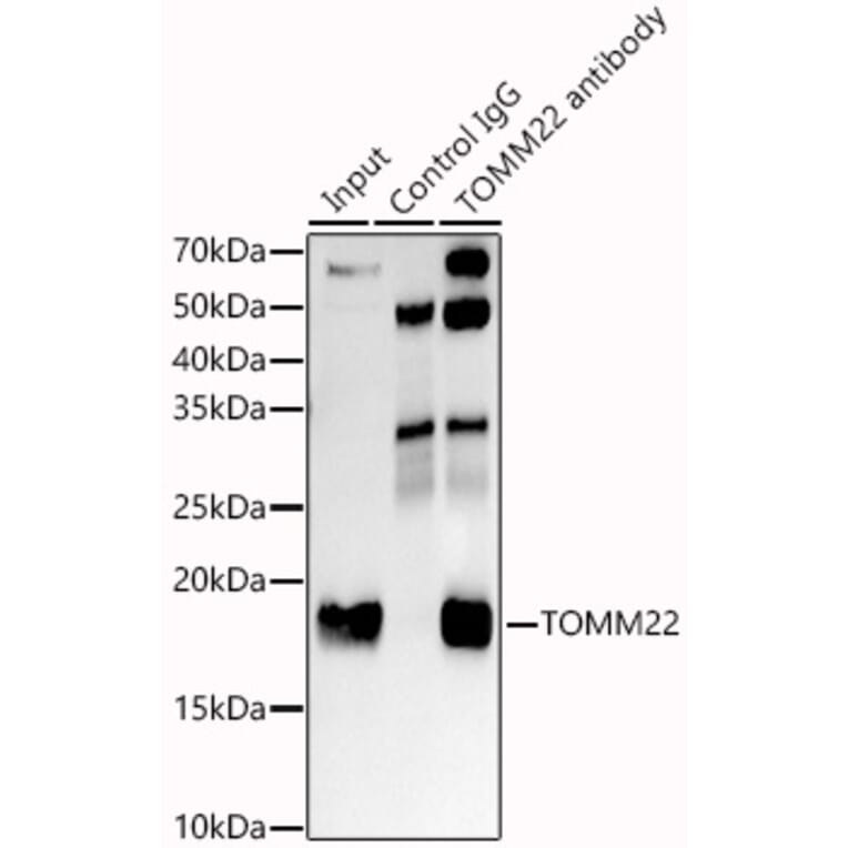Western Blot - Anti-TOMM22/TOM22 Antibody [ARC1688] (A306788) - Antibodies.com