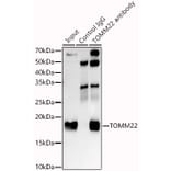 Western Blot - Anti-TOMM22/TOM22 Antibody [ARC1688] (A306788) - Antibodies.com
