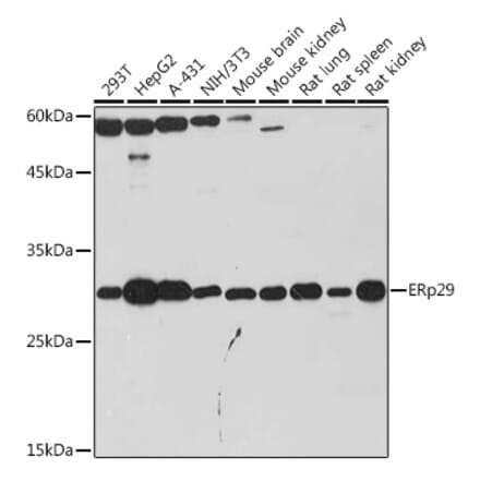 Western Blot - Anti-ERp29 Antibody [ARC2295] (A306789) - Antibodies.com