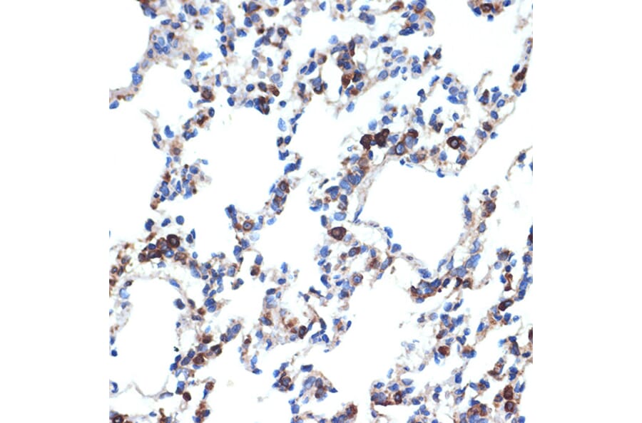 Immunohistochemistry - Anti-ERp29 Antibody [ARC2295] (A306789) - Antibodies.com