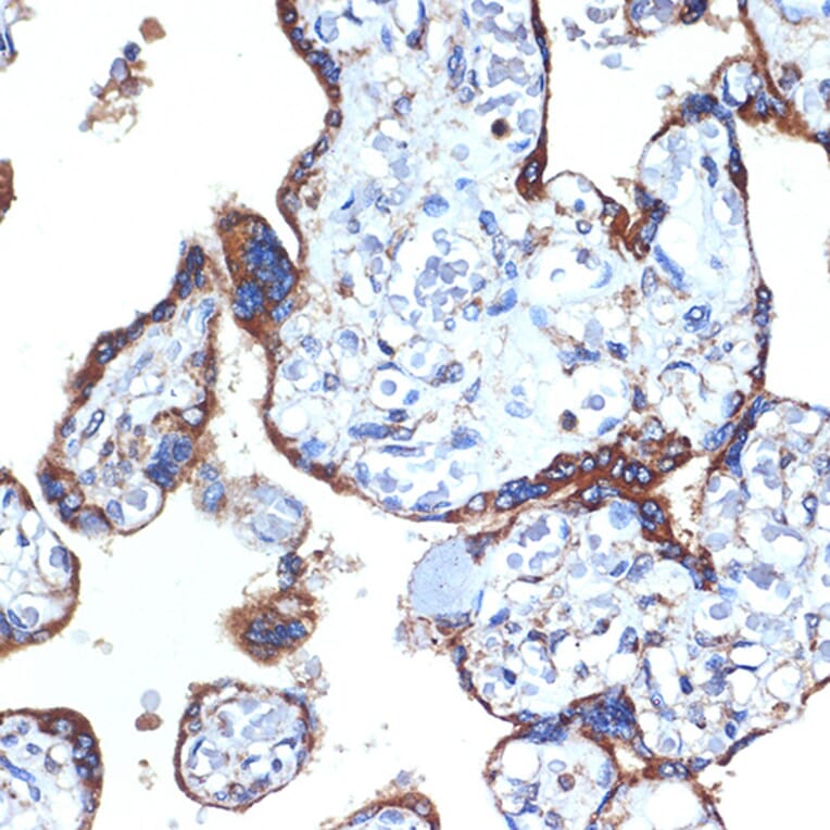 Immunohistochemistry - Anti-ERp29 Antibody [ARC2295] (A306789) - Antibodies.com