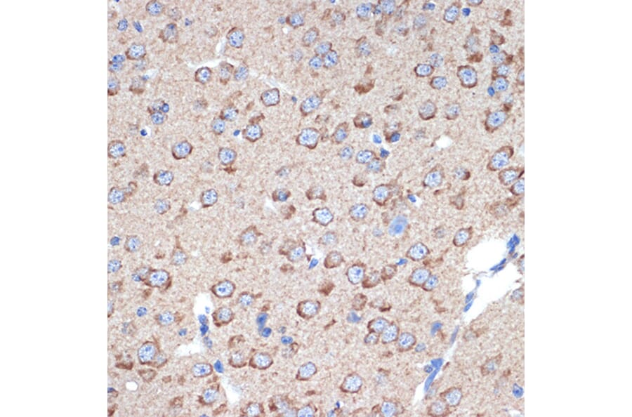 Immunohistochemistry - Anti-ERp29 Antibody [ARC2295] (A306789) - Antibodies.com