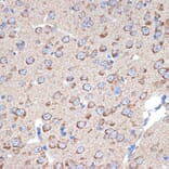 Immunohistochemistry - Anti-ERp29 Antibody [ARC2295] (A306789) - Antibodies.com