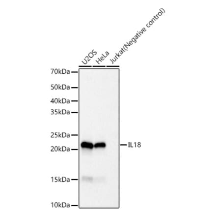 Western Blot - Anti-IL-18 Antibody [ARC56557] (A306790) - Antibodies.com