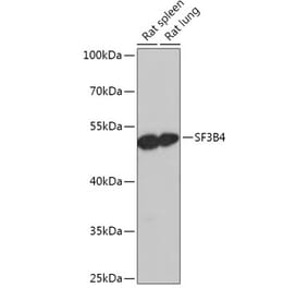 Western Blot - Anti-SF3B4 Antibody (A306795) - Antibodies.com