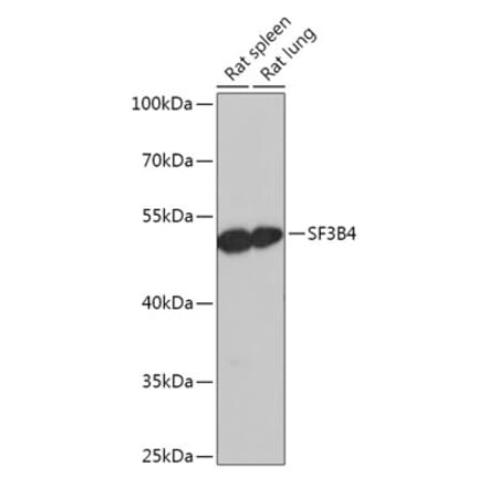 Western Blot - Anti-SF3B4 Antibody (A306795) - Antibodies.com