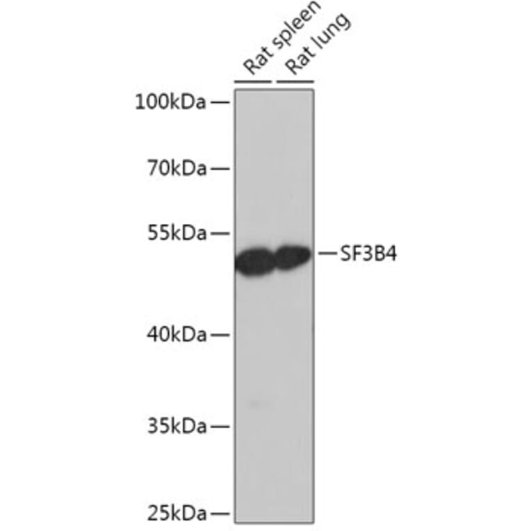 Western Blot - Anti-SF3B4 Antibody (A306795) - Antibodies.com