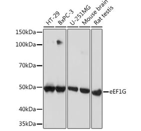 Western Blot - Anti-Elongation factor 1-gamma Antibody [ARC1287] (A306796) - Antibodies.com