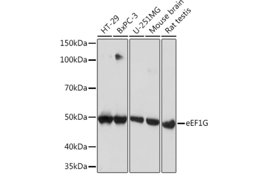 Western Blot - Anti-Elongation factor 1-gamma Antibody [ARC1287] (A306796) - Antibodies.com