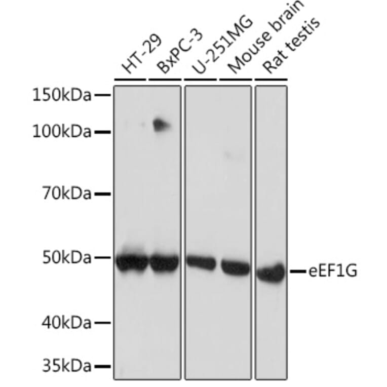 Western Blot - Anti-Elongation factor 1-gamma Antibody [ARC1287] (A306796) - Antibodies.com