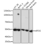 Western Blot - Anti-Elongation factor 1-gamma Antibody [ARC1287] (A306796) - Antibodies.com