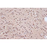 Immunohistochemistry - Anti-Elongation factor 1-gamma Antibody [ARC1287] (A306796) - Antibodies.com