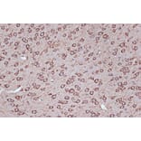 Immunohistochemistry - Anti-Elongation factor 1-gamma Antibody [ARC1287] (A306796) - Antibodies.com