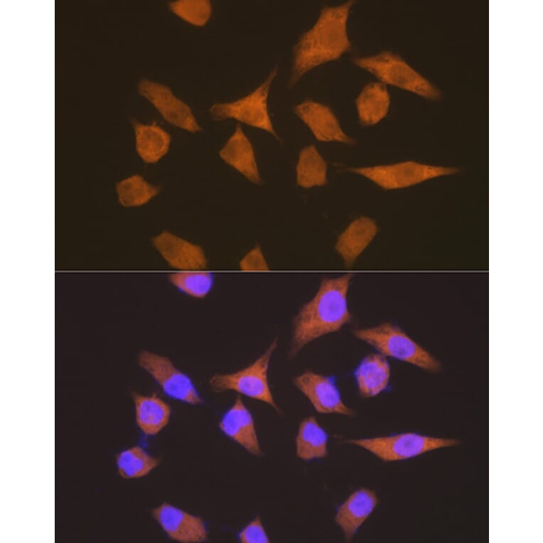 Immunofluorescence - Anti-Elongation factor 1-gamma Antibody [ARC1287] (A306796) - Antibodies.com