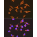 Immunofluorescence - Anti-Elongation factor 1-gamma Antibody [ARC1287] (A306796) - Antibodies.com