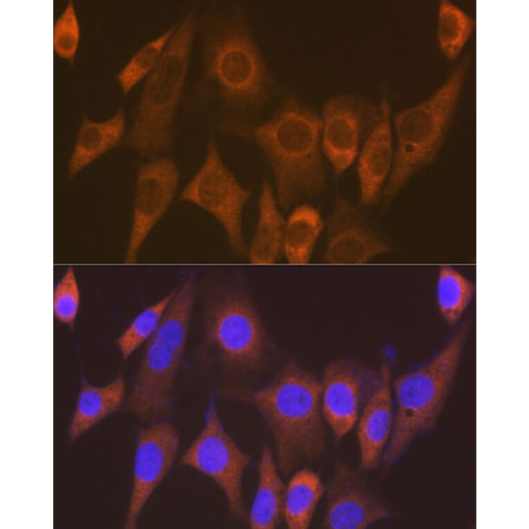 Immunofluorescence - Anti-Elongation factor 1-gamma Antibody [ARC1287] (A306796) - Antibodies.com