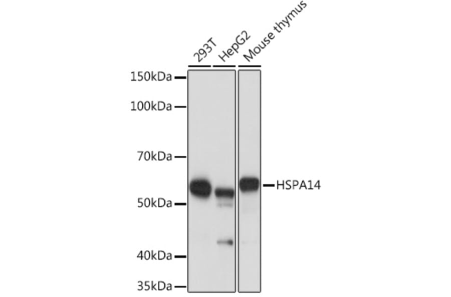 Western Blot - Anti-HSPA14 Antibody [ARC1908] (A306797) - Antibodies.com