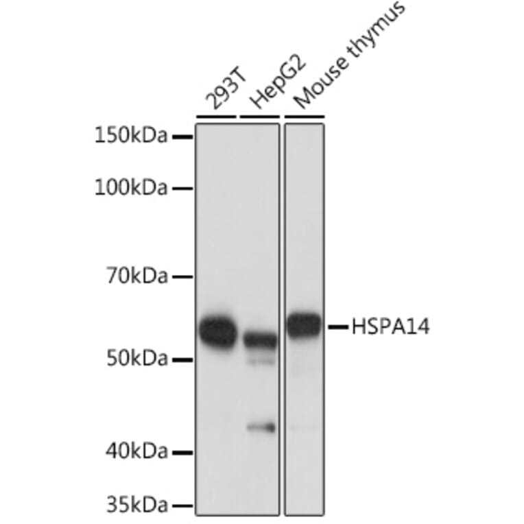 Western Blot - Anti-HSPA14 Antibody [ARC1908] (A306797) - Antibodies.com