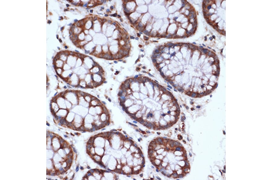 Immunohistochemistry - Anti-HSPA14 Antibody [ARC1908] (A306797) - Antibodies.com