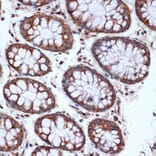 Immunohistochemistry - Anti-HSPA14 Antibody [ARC1908] (A306797) - Antibodies.com