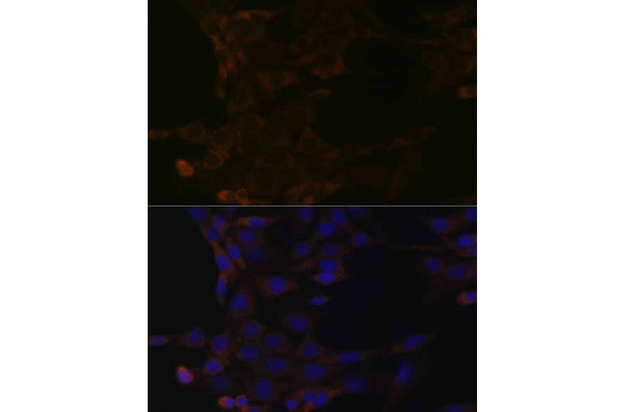 Immunofluorescence - Anti-HSPA14 Antibody [ARC1908] (A306797) - Antibodies.com