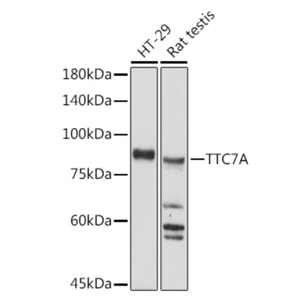 Western Blot - Anti-TTC7A Antibody (A306801) - Antibodies.com